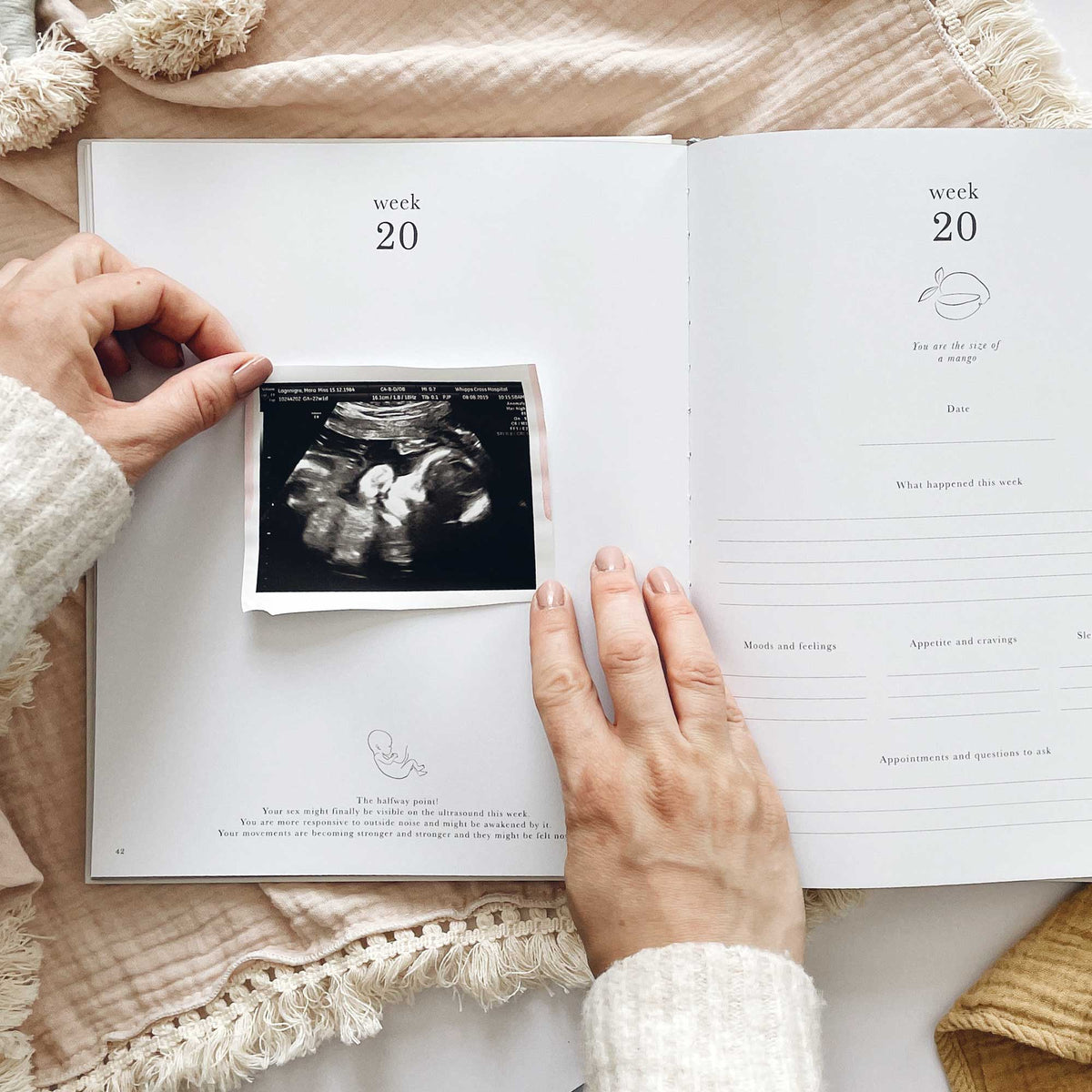 My Pregnancy Journal - Safari with Gilded Edges